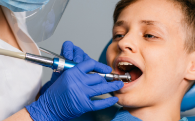 Acudir al dentista: dudas frecuentes