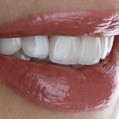 estética dental en barcelona
