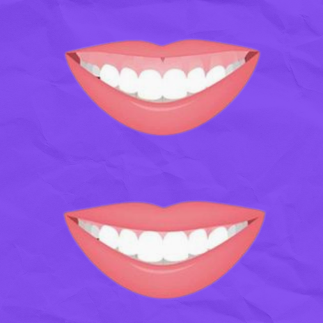la sonrisa gingival