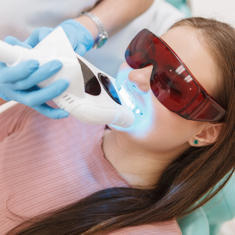 blanqueamiento dental en Barcelona