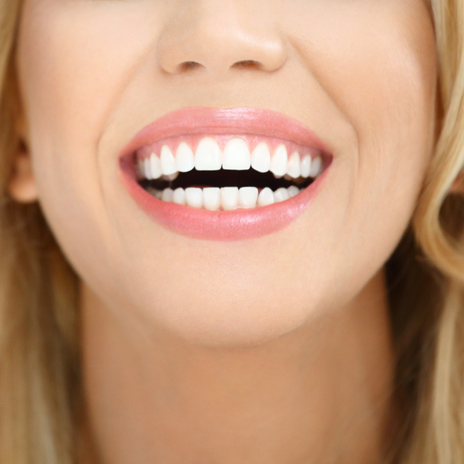 luce tu sonrisa en verano