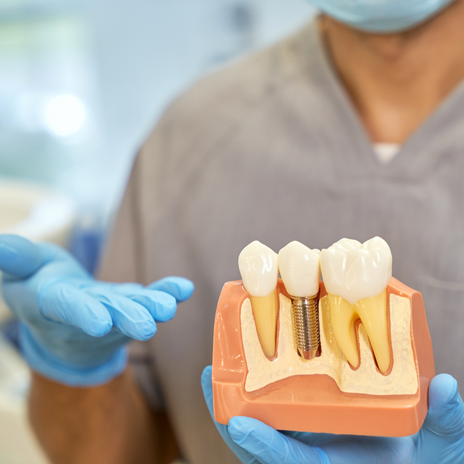 tratamiento de implantología dental en barcelona