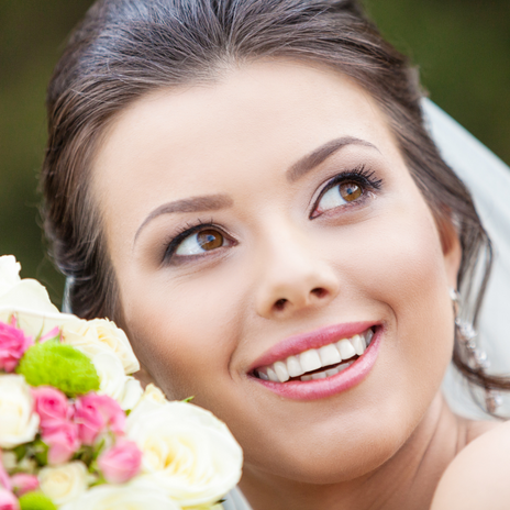 carillas dentales para bodas en Barcelona
