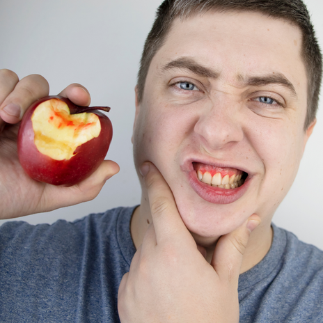 tratamientos para enfermedades periodontales en barcelona