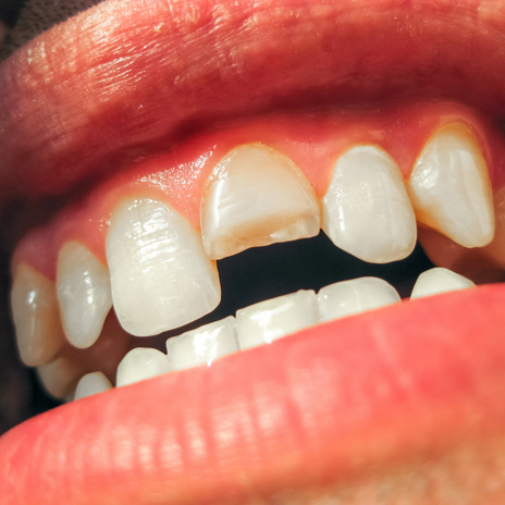 urgencias dentales en barcelona