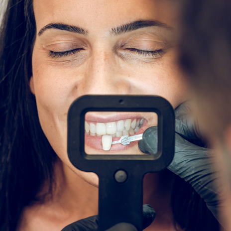 contorneado de dientes