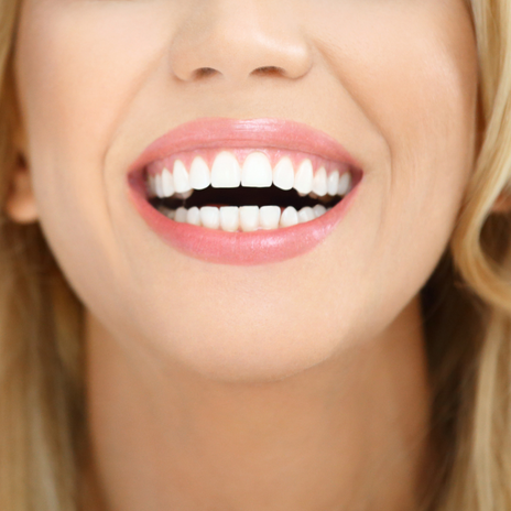 Día Mundial de la Sonrisa: ¿Cómo mantener una sonrisa sana?