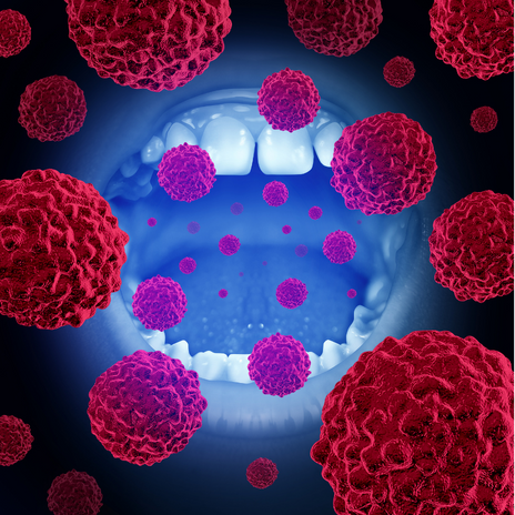Prevención del cáncer oral