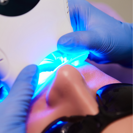 ¿Cómo blanqueamos los dientes en MyDentiss?