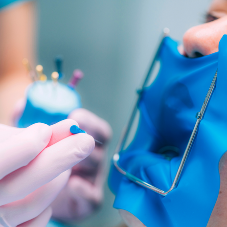 ¿En qué consiste la endodoncia?