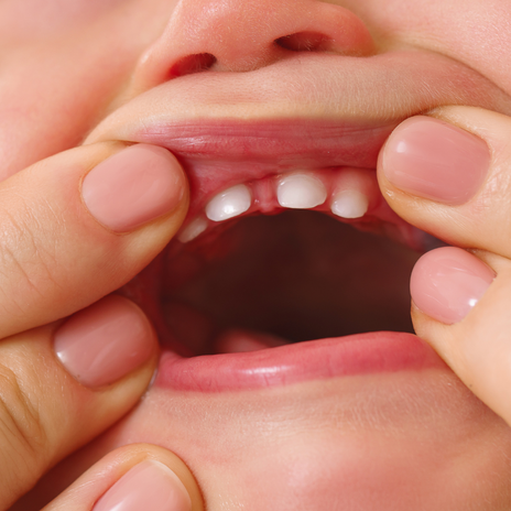 dientes de leche