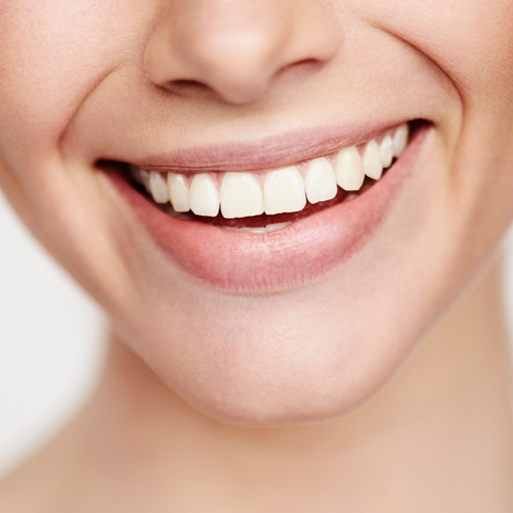 sonrisa gingival