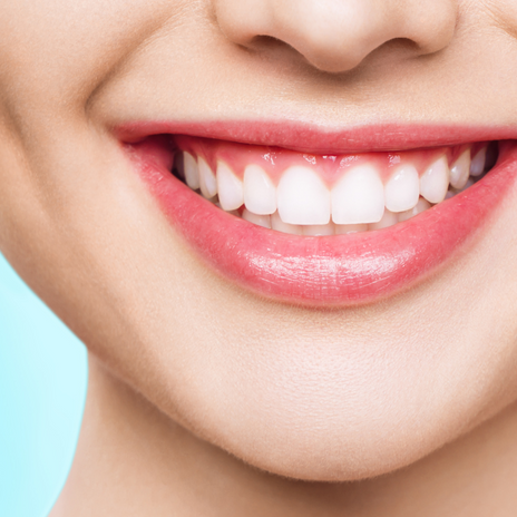 dientes nuevos