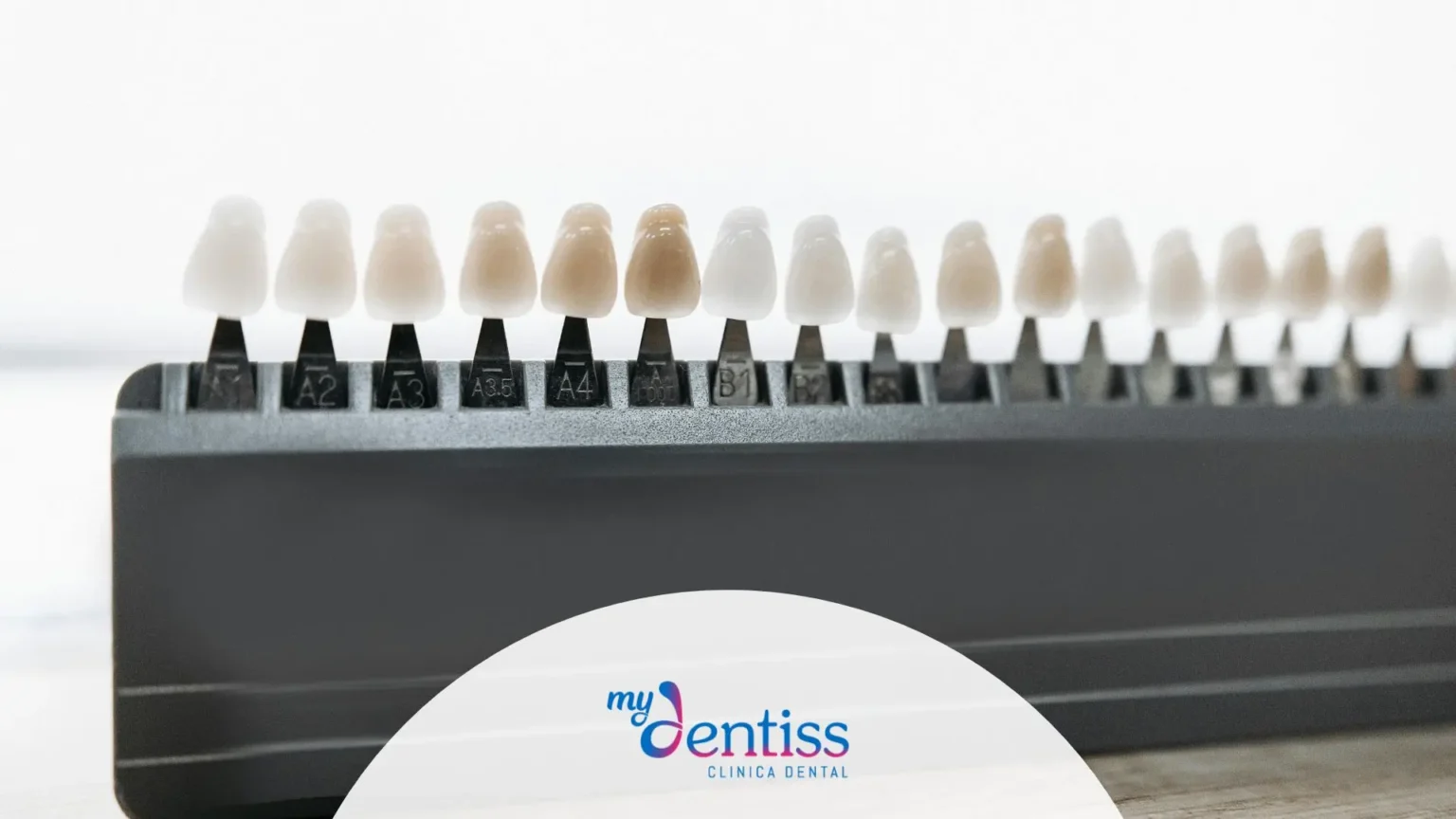 Imagen de carillas dentales usada como fondo para blog de mydentiss