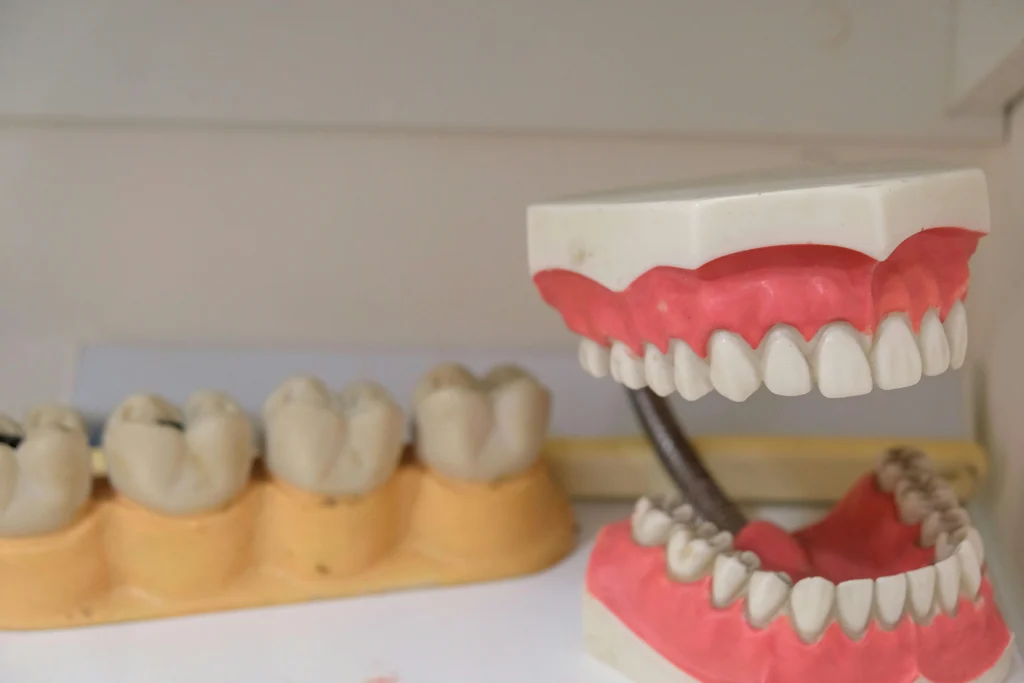 Imagen de dentadura falsa cusada como banner de página dentadura fija Mydentiss