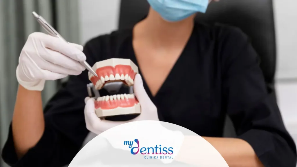 Modelo dental mostrando diferencias entre un implante y un puente para reemplazar un diente
