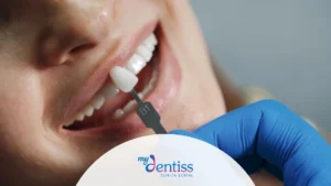 Dentista mostrando carillas de porcelana y composite a paciente