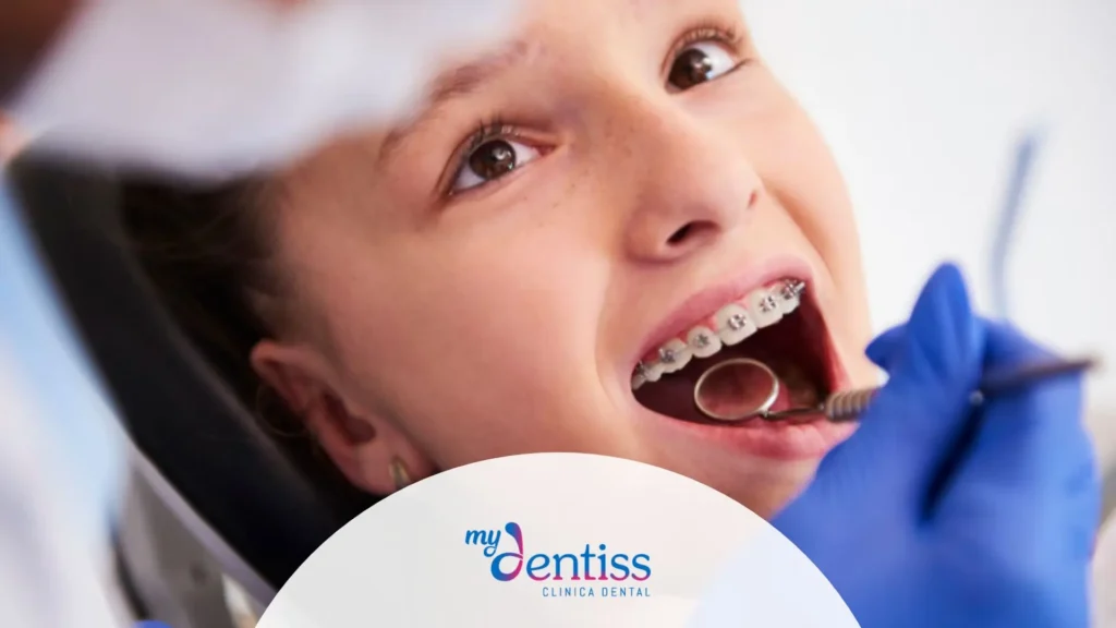 Comparativa entre ortodoncia invisible y brackets tradicionales