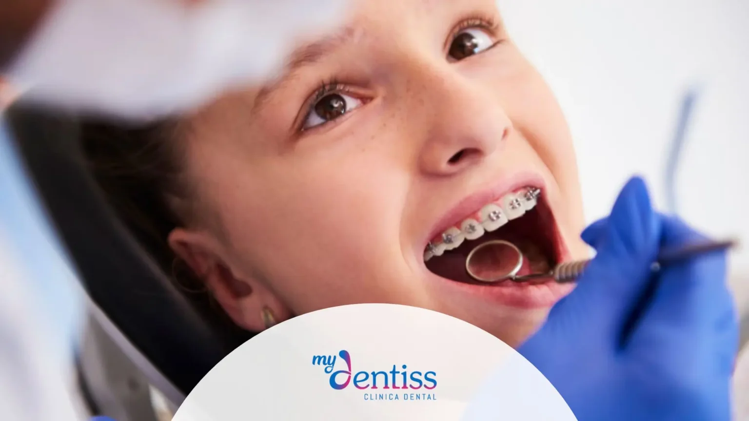 Comparativa entre ortodoncia invisible y brackets tradicionales