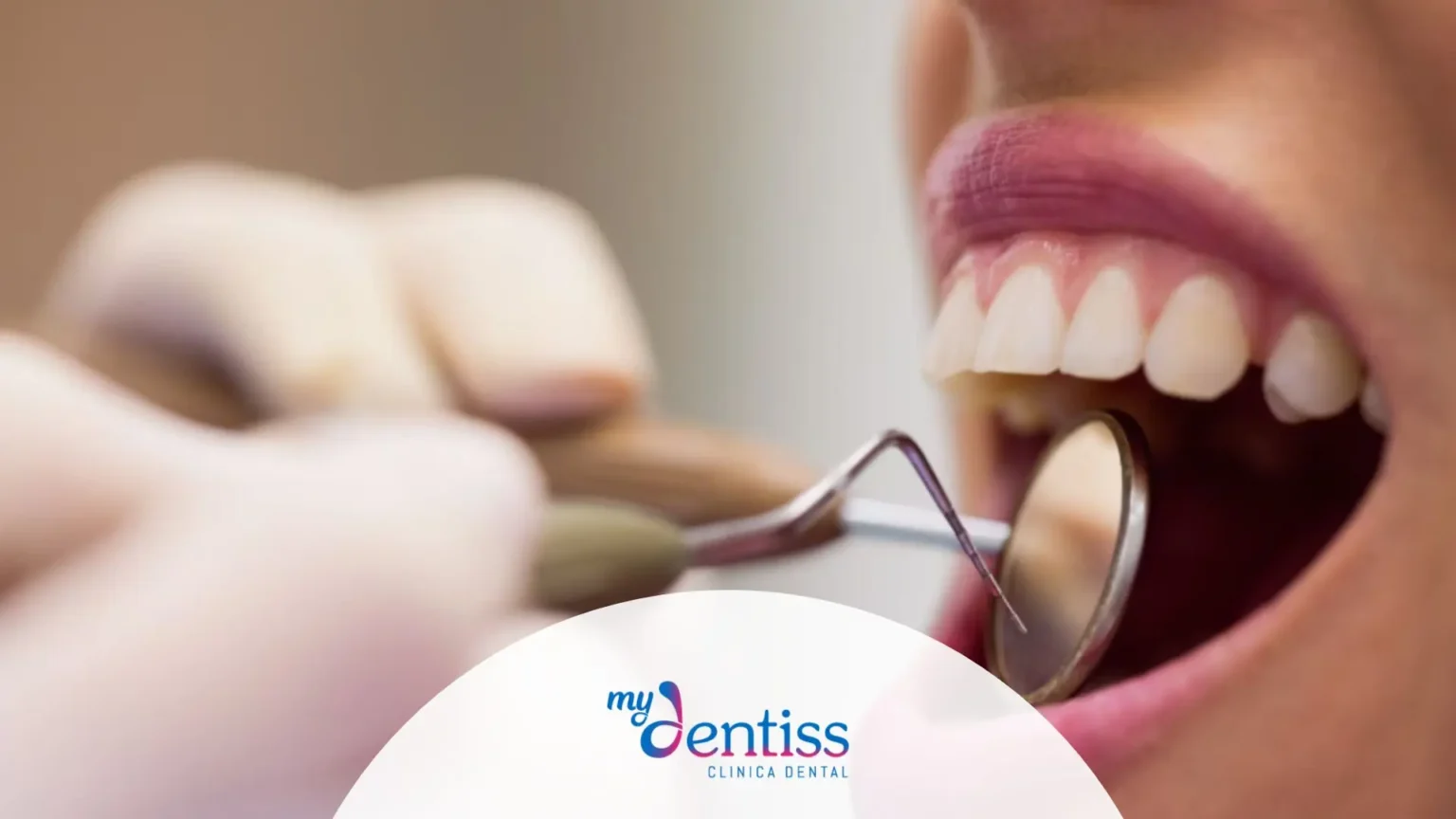 Paciente con bruxismo nocturno mostrando desgaste dental y tensión mandibular