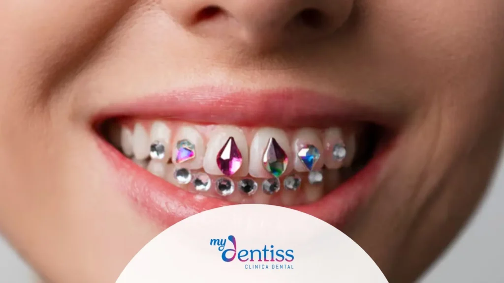Imagen informativa que muestra piercings orales y tatuajes dentales, destacando los riesgos reales que pueden tener sobre dientes, encías y salud bucodental.
