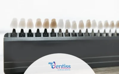 ¿Cuánto duran las carillas dentales?