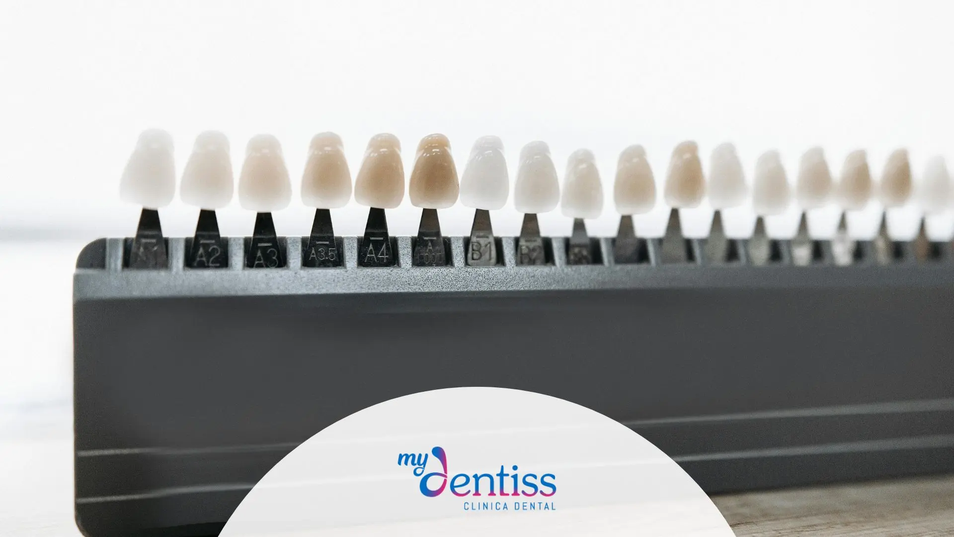 Imagen de carillas dentales usada como fondo para blog de mydentiss