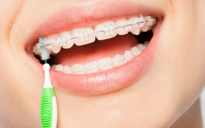 Consejos de buenos hábitos con ortodoncia