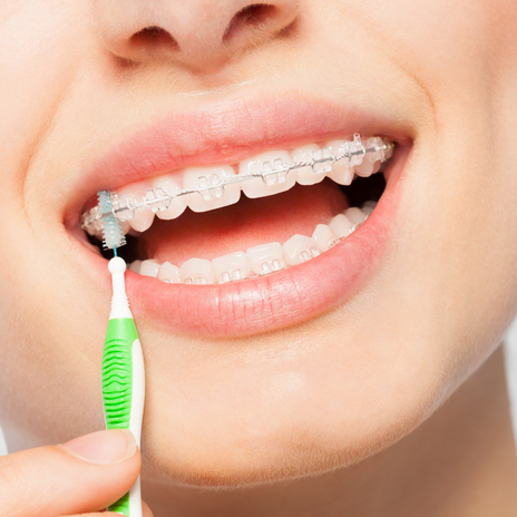Ortodoncia: cómo mantener una buena higiene oral