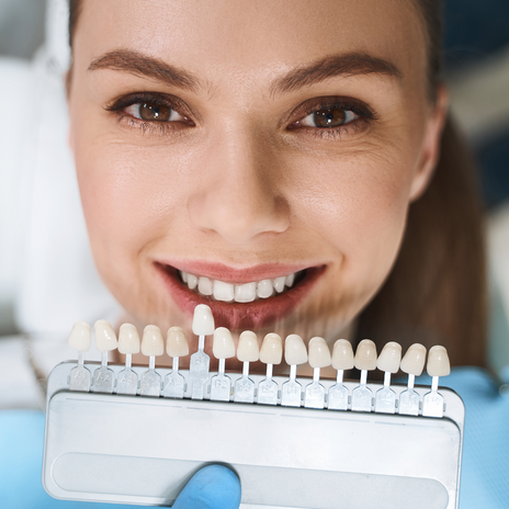 Mitos de las carillas dentales