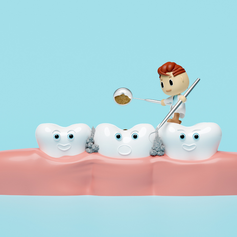 las caries dental