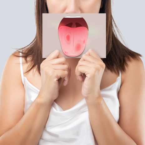4 técnicas para la limpieza lingual 