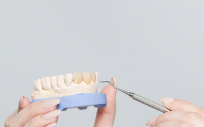 Coronas dentales: lo que debes saber