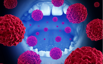 El cáncer oral, la patología bucodental más grave