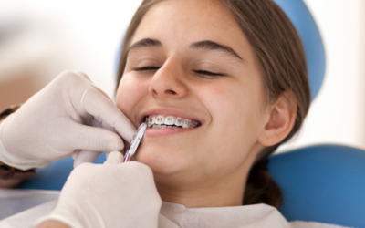 ¿Cuándo necesitan ortodoncia los niños?