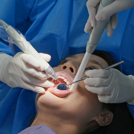 ¿Qué hacer frente a un implante dental infectado?