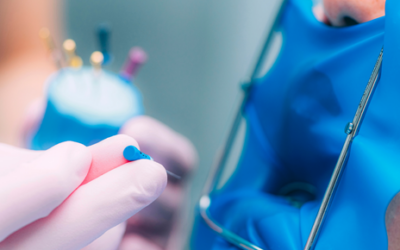 ¿En qué consiste la endodoncia?