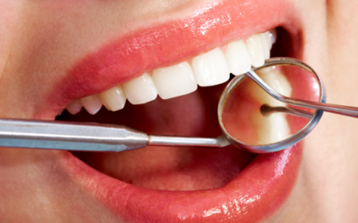 Consejos para evitar las manchas dentales