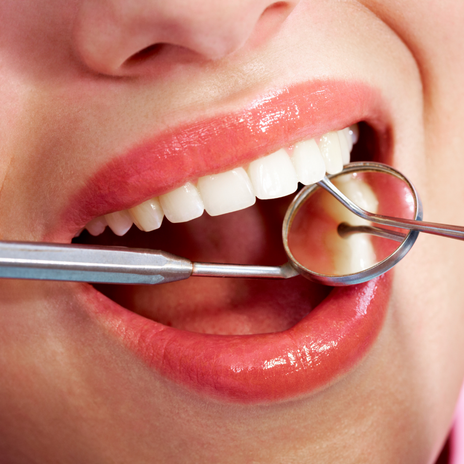 Estética dental: tipos de manchas dentales