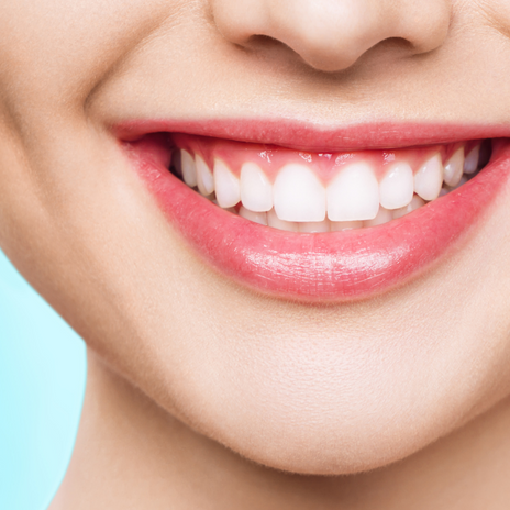 Cuidado de tus dientes nuevos (soportados por implantes)