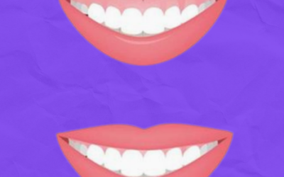 Sonrisa Gingival: Descubre Cómo Transformar tu Sonrisa en MyDentiss