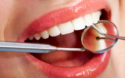 Tratamientos de estética dental: este 2021 apuesta por tu sonrisa
