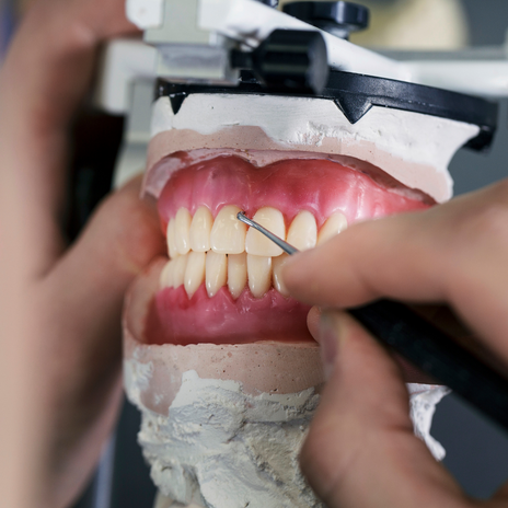 Prótesis dentales en barcelona