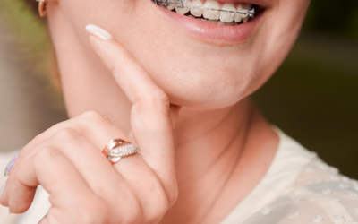 Ortodoncia: cómo mejorar tu dentadura a cualquier edad