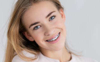 3 claves sobre la ortodoncia con brackets