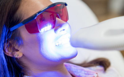 Mitos del blanqueamiento dental