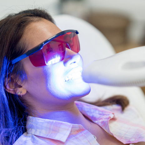 blanqueamiento dental con Philips Zoom en Barcelona