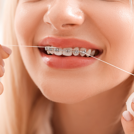 5 tips sobre la higiene bucodental con ortodoncia