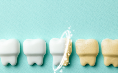 ¿Los blanqueamientos dentales dañan los dientes?