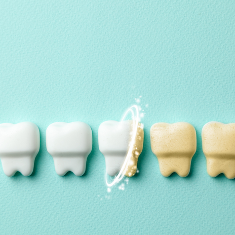 ¿Los blanqueamientos dentales dañan los dientes?
